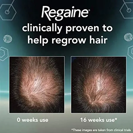 Regaine For Men Hair Regrowth Foam 3 x 73ml